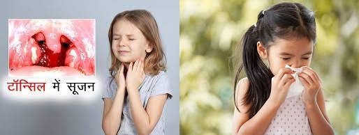 घसादुखी टॉन्सिलसूज सर्दी